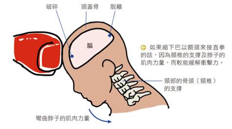 顏面凹陷拳|顏面凹陷拳